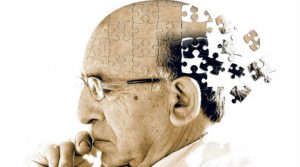 Alzheimer-disease-patients-720x400